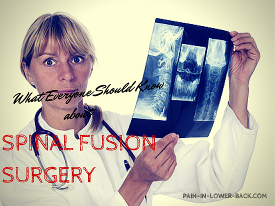 spinal fusion surgery