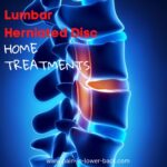 home treatments for a lumbar herniated disc