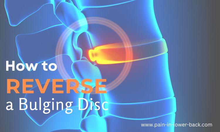 how to heal a bulging disc in lower back